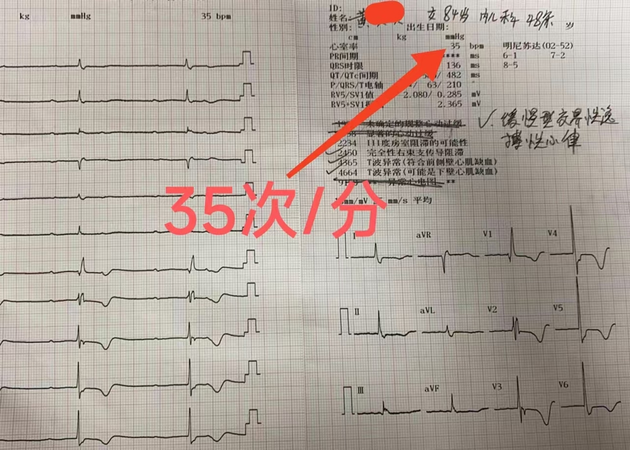 精准介入重“启”心跳｜双腔永久心脏起搏器植入为生命续航