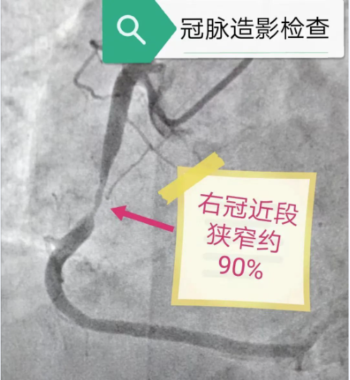 【钦中医技术】“针”技术“心”发展——经远端桡动脉穿刺冠脉介入诊疗技术