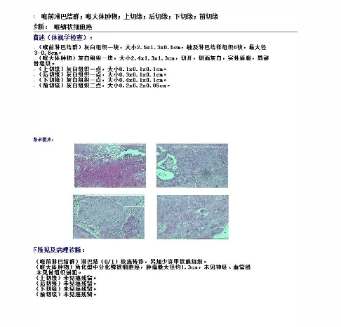 【钦中医技术】喉恶性肿物切除术，让患者重获新“声”