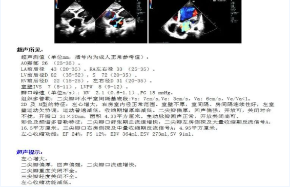 【钦中医技术】CRT-D起搏器植入术——让衰竭的心脏重获生机