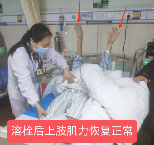 【钦中医技术】厉害了！看他们如何快速溶栓，为卒中患者脑血管排“雷”！