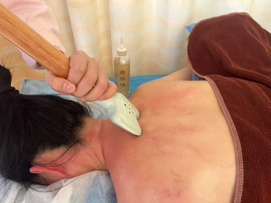 【钦中医特色】一根小棍通经络，缓解疼痛有妙招——棍针拨筋疗法